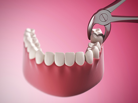 Summit Family Dentistry | Cosmetic Dentistry, Dental Cleanings and Extractions